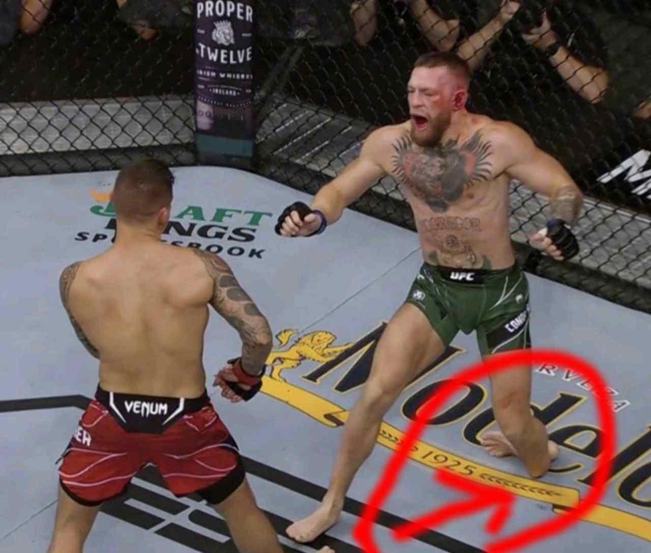 McGregor infortunio